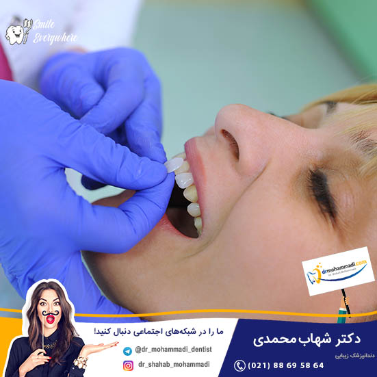 آیا با داشتن لمینیت می توانم نخ دندان استفاده کنم؟ - کلینیک دندانپزشکی دکتر شهاب محمدی